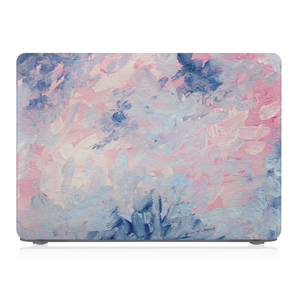 Macbook Case - Positive Quote - My Brain Has Too Many Tabs Open