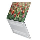 MAC-ASORTED01-TULIPGARDEN-SHOW-3