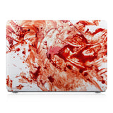 MAC-BLOOD-01BLOODSPLATTER