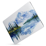 Protect your macbook  with the #1 best-selling hardshell case with Watercolor View design