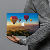 hardshell case with Nature Beauty design combines a sleek hardshell design with vibrant colors for stylish protection against scratches, dents, and bumps for your Macbook