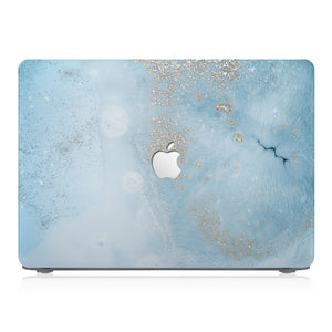 This lightweight, slim hardshell with Marble Gold design is easy to install and fits closely to protect against scratches