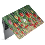 hardshell case with Oil Painting Abstract design has matte finish resists scratches