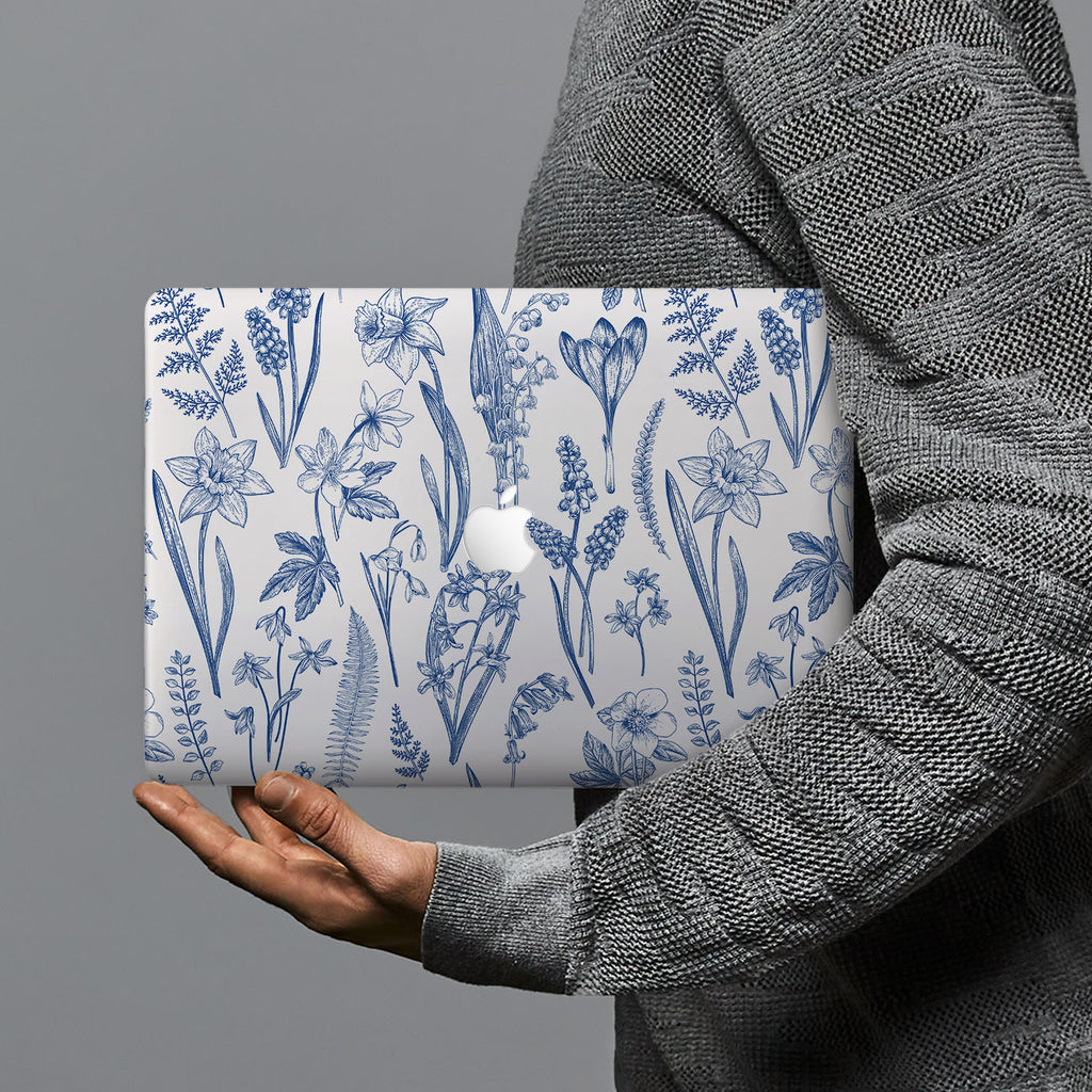 hardshell case with Flower design combines a sleek hardshell design with vibrant colors for stylish protection against scratches, dents, and bumps for your Macbook