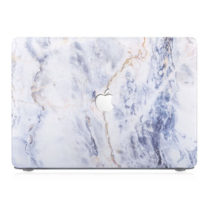 This lightweight, slim hardshell with Marble design is easy to install and fits closely to protect against scratches