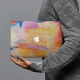 hardshell case with Splash design combines a sleek hardshell design with vibrant colors for stylish protection against scratches, dents, and bumps for your Macbook