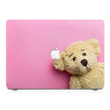 This lightweight, slim hardshell with Bear design is easy to install and fits closely to protect against scratches