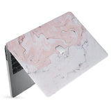 hardshell case with Pink Marble design has matte finish resists scratches